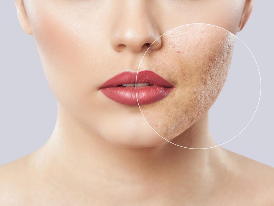 skin tightening treatment houston tx