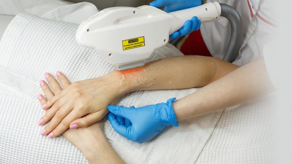 Intense Pulsed Light (IPL) Solution for Brighter Complexion