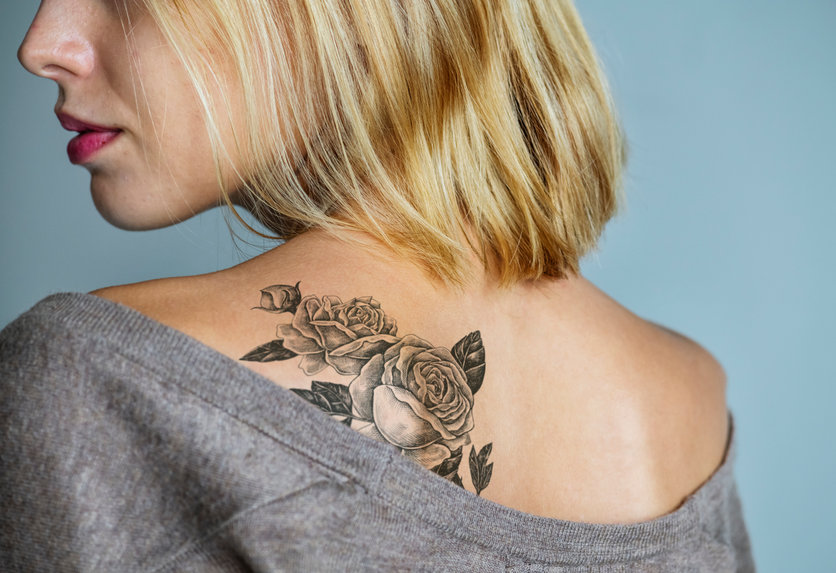 tattoo removal  Laser tattoo removal Houston is the most ef  Flickr