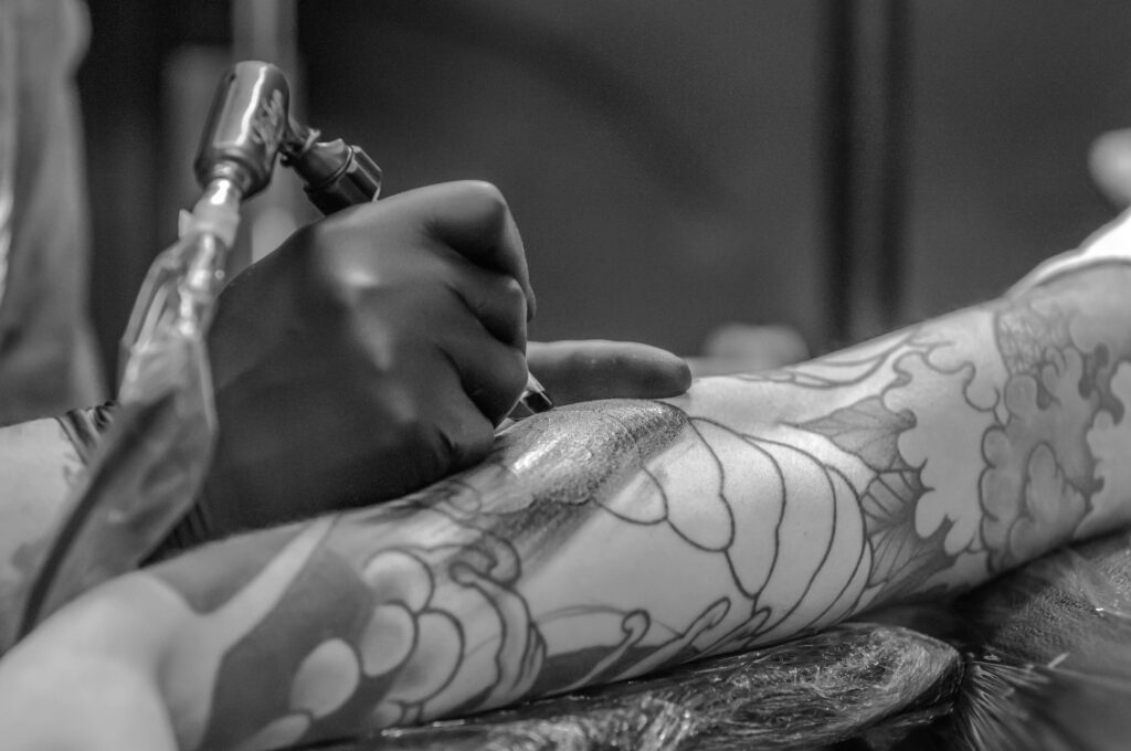 laser tattoo removal at houston med spa